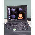 Ultrasonidodoppler Farbe Portatil u. Portable der ecografia Dopplerfarbe